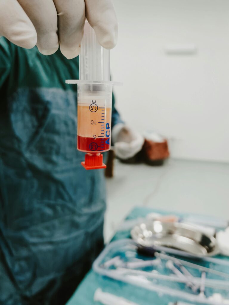 Close-up of a syringe with blood in a laboratory. Medical setting with focus on healthcare procedures.
