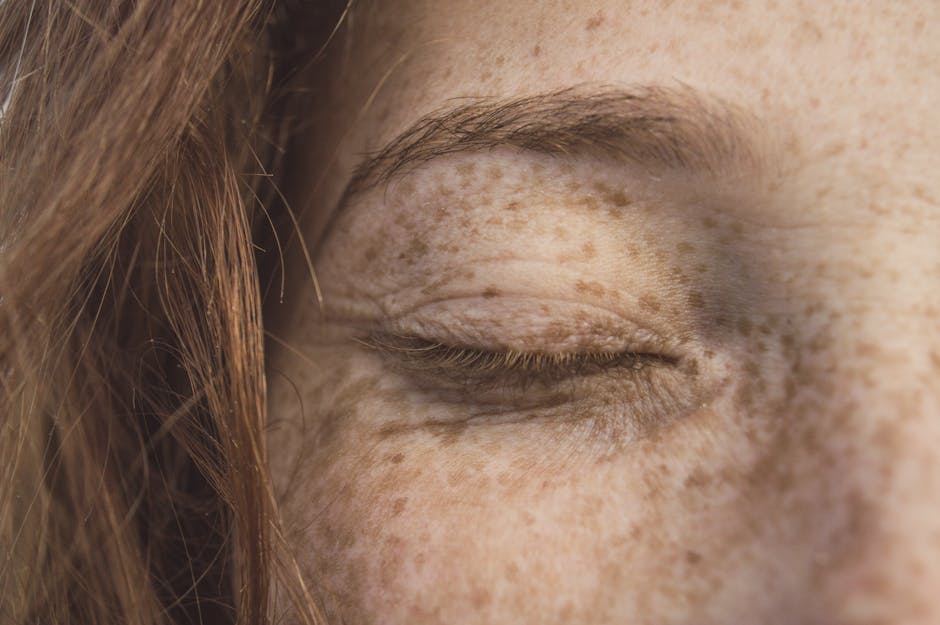Detailed close-up of a person's freckled skin with eye closed, highlighting texture and color.